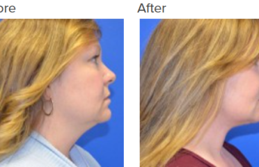 CENTRAL OHIO PLASTIC SURGERY