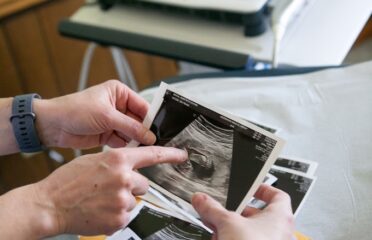 Forward Fertility