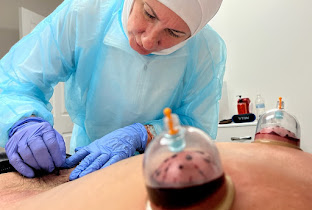 HIO Homeopathy Hijama Fire & Sports Cupping Therapy and HIO Holistic Pets!