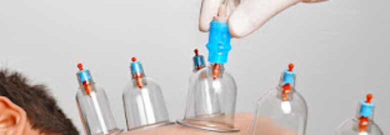 Holistic Hijama Cupping