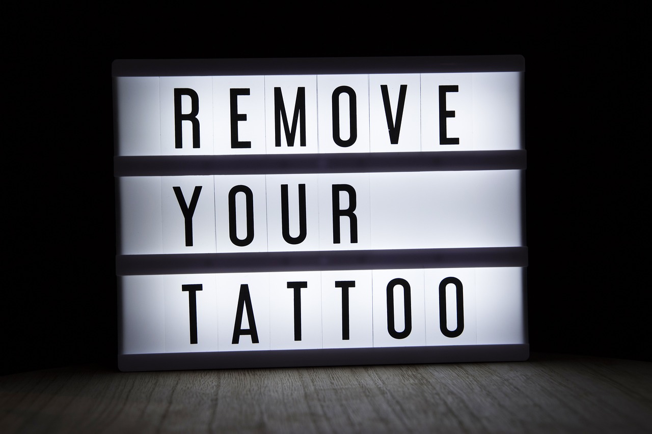 Tatoo Removal
